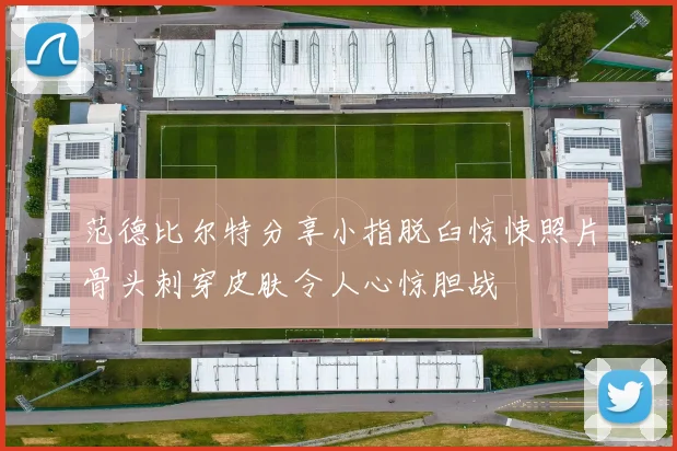 范德比尔特分享小指脱臼惊悚照片骨头刺穿皮肤令人心惊胆战